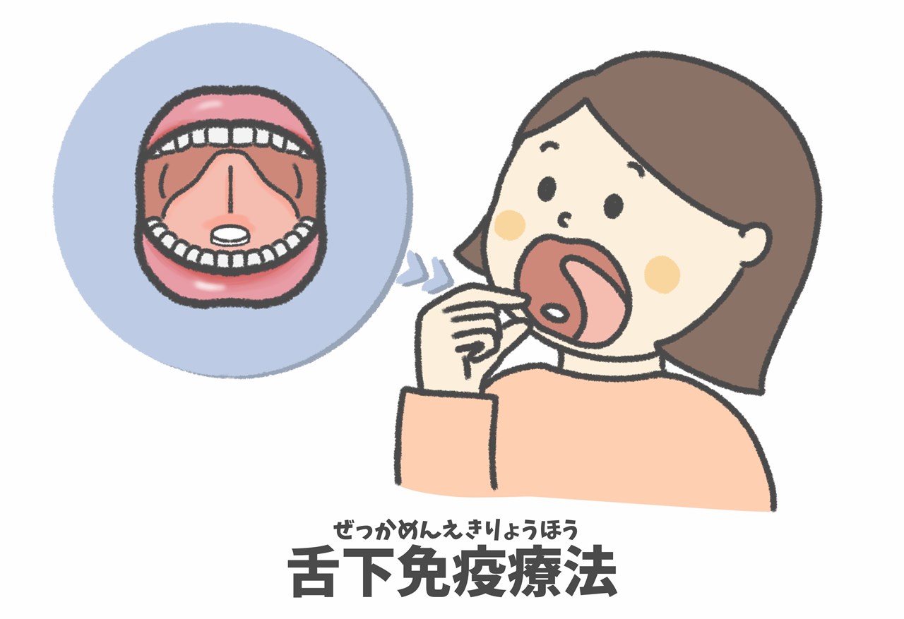 舌下免疫療法（ぜっかめんえきりょうほう）の効果とは